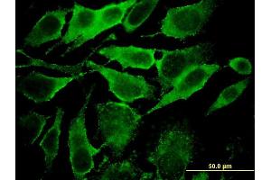 Immunofluorescence of monoclonal antibody to YKT6 on HeLa cell. (YKT6 抗体  (AA 99-198))