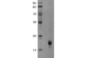 Western Blotting (WB) image for Cytochrome b5 (CYTB5) (Transcript Variant 3) protein (His tag) (ABIN2712810)