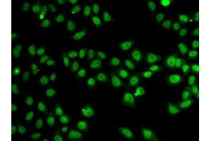 Immunofluorescence analysis of MCF-7 cells using SND1 antibody. (SND1 抗体  (AA 26-285))