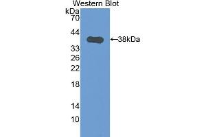 Detection of Recombinant CK1, Mouse using Polyclonal Antibody to Cytokeratin 1 (CK1) (Cytokeratin 1 抗体  (AA 189-497))