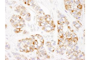 Immunohistochemistry (IHC) image for anti-Prohibitin (PHB) (AA 222-272) antibody (ABIN7453838)