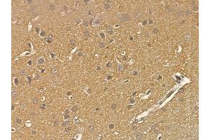 SCLT1 Mouse Monoclonal Antibody at 1/100 staining rat brain tissue by IHC-P. (Sclt1 抗体)