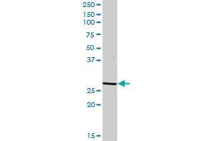 DCI MaxPab polyclonal antibody. (DCI 抗体  (AA 1-243))