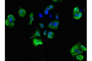 Immunofluorescent analysis of MCF-7 cells using ABIN7170803 at dilution of 1:100 and Alexa Fluor 488-congugated AffiniPure Goat Anti-Rabbit IgG(H+L) (STOML3 抗体  (AA 205-291))