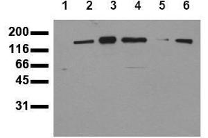 Western Blotting (WB) image for anti-Receptor Tyrosine-Protein Kinase ErbB-3 (ERBB3) (C-Term) antibody (ABIN126793) (ERBB3 抗体  (C-Term))