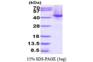 Speckle-Type POZ Protein (SPOP-B) (AA 1-374) protein (His tag)