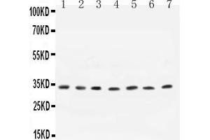 Anti- Cyclin D1 antibody, All Western blottingAll lanes: Anti-CCND1 at 0.