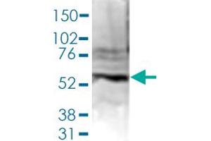 Western Blot (Cell lysate) analysis of 40 ug nuclear extracts of Hela cells. (PAPD5 抗体  (C-Term))