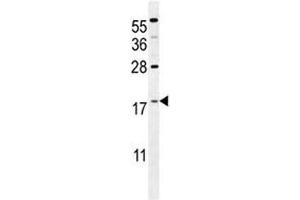 S100A4 antibody western blot analysis in mouse NIH3T3 lysate. (s100a4 抗体  (AA 1-30))