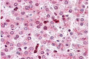 Human Liver: Formalin-Fixed, Paraffin-Embedded (FFPE) (COMT 抗体  (Internal Region))