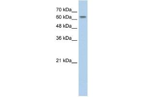 SLC38A1 antibody used at 2. (SLC38A1 抗体  (Middle Region))