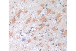 Used in DAB staining on fromalin fixed paraffin- embedded brain tissue (TRIM3 抗体  (AA 2-152))