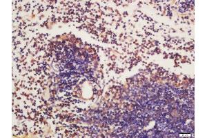 Formalin-fixed and paraffin embedded mouse spleen labeled with Rabbit Anti-BTK (Tyr223) Polyclonal Antibody, Unconjugated  at 1:200 followed by conjugation to the secondary antibody and DAB staining (BTK 抗体  (pTyr223))