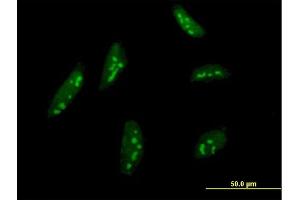 Immunofluorescence of monoclonal antibody to BMP2K on HeLa cell. (BMP2K 抗体  (AA 540-650))