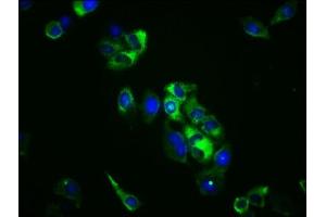 Immunofluorescence staining of Hela cells with ABIN7171265 at 1:100, counter-stained with DAPI. (STXBP5 抗体  (AA 515-610))