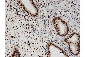 Immunoperoxidase of monoclonal antibody to RBM3 on formalin-fixed paraffin-embedded human endometrium. (RBM3 抗体  (AA 1-80))
