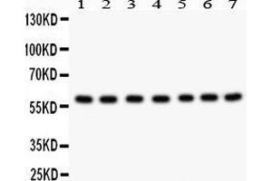 Western Blotting (WB) image for anti-Heat shock factor protein 2 (HSF2) (AA 82-102), (Middle Region) antibody (ABIN3044217)