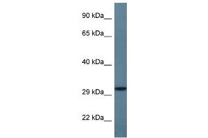 WB Suggested Anti-STX11 Antibody Titration: 1. (Syntaxin 11 抗体  (C-Term))