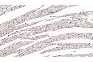 Detection of TNC in Rat Cardiac Muscle Tissue using Polyclonal Antibody to Tenascin C (TNC)