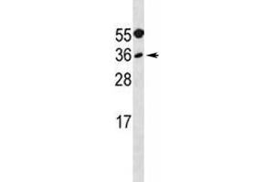 MYF5 antibody western blot analysis in A549 lysate. (MYF5 抗体  (AA 7-36))