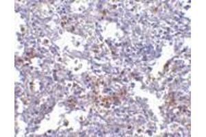 Immunohistochemistry of EVER1 in human spleen with EVER1 antibody at 2. (TMC6 抗体  (N-Term))