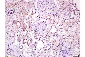 Formalin-fixed and paraffin embedded human kidney labeled with Anti-Wnt16 Polyclonal Antibody, Unconjugated (ABIN1387899) at 1:200 followed by conjugation to the secondary antibody and DAB staining (WNT16 抗体  (AA 220-265))