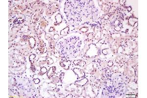 Formalin-fixed and paraffin embedded human kidney labeled with Anti-Wnt16 Polyclonal Antibody, Unconjugated (ABIN1387899) at 1:200 followed by conjugation to the secondary antibody and DAB staining