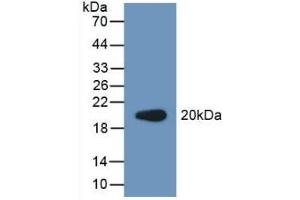 Detection of Recombinant PCPE2, Human using Polyclonal Antibody to Procollagen C Proteinase Enhancer 2 (PCPE2) (PCOLCE2 抗体  (AA 297-415))
