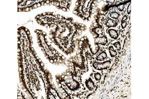 IHC analysis of DDX5 using anti-DDX5 antibody (ABIN7602561). (DDX5 抗体  (AA 85-328))