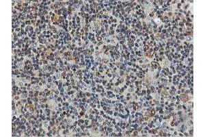 Image no. 11 for anti-Farnesyl-Diphosphate Farnesyltransferase 1 (FDFT1) antibody (ABIN1498243)