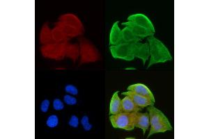 ABIN6257620 and ABIN6275306 staining Hela cells(30 min of UV treatment) by IF/ICC. (NEGR1 抗体  (Internal Region))