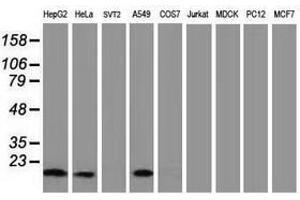 Image no. 6 for anti-Destrin (Actin Depolymerizing Factor) (DSTN) antibody (ABIN1497910) (Destrin 抗体)