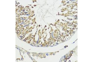 Immunohistochemistry of paraffin-embedded rat testis using H antibody (ABIN7267593) at dilution of 1:100 (40x lens). (HACE1 抗体  (AA 1-100))