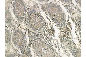ABIN6263060 and ABIN6272509 at 1/100 staining human normal colon tissue by IHC-P. (MAGEA11 抗体  (C-Term))