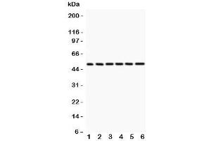 Western blot testing of p50 antibody and 1:  rat spleen;  2: (r) PC-12; and human samples 3: HeLa;  4: A431;  5: Jurkat;  6: MCF-7;  Predicted/observed size: 50/105KD depending on sample (CD40 抗体  (AA 1-360))