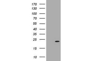 Image no. 1 for anti-Leucine Zipper and CTNNBIP1 Domain Containing (LZIC) antibody (ABIN1499240) (LZIC 抗体)