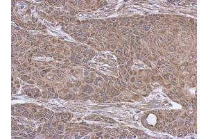 Immunohistochemistry (IHC) image for anti-Succinate-CoA Ligase, ADP-Forming, beta Subunit (SUCLA2) antibody (ABIN2856701)
