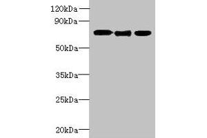 Western blot All lanes: SLC23A1 antibody at 3 μg/mL Lane 1: A549 whole cell lysate Lane 2: Mouse liver tissue Lane 3: Mouse kidney tissue Secondary Goat polyclonal to rabbit IgG at 1/10000 dilution Predicted band size: 65, 66, 29 kDa Observed band size: 65 kDa (SLC23A1 抗体  (AA 173-259))