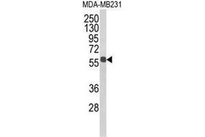 Western blot analysis of ALDH3B1 Antibody (Center) in MDA-MB231 cell line lysates (35ug/lane). (ALDH3B1 抗体  (Middle Region))
