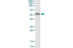 Immunoprecipitation of GIF transfected lysate using anti-GIF monoclonal antibody and Protein A Magnetic Bead , and immunoblotted with GIF MaxPab rabbit polyclonal antibody. (Intrinsic Factor 抗体  (AA 318-417))