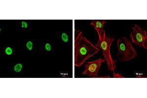 ICC/IF Image SAE1 antibody detects SAE1 protein at nucleus by immunofluorescent analysis. (SAE1 抗体)