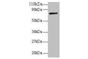 Western blot All lanes: ANXA6 antibody at 2 μg/mL + Rat liver tissue Secondary Goat polyclonal to rabbit IgG at 1/10000 dilution Predicted band size: 76, 73 kDa Observed band size: 76 kDa (ANXA6 抗体  (AA 2-245))