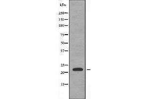 Western blot analysis of extracts from Jurkat cells, using DTYMK antibody. (DTYMK 抗体  (Internal Region))