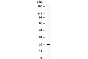 Western blot testing of human K562 cell lysate with G-CSF antibody.