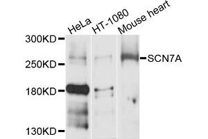 Western blot analysis of extracts of various cells, using SCN7A antibody. (SCN7A 抗体)