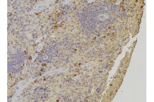 ABIN6272244 at 1/100 staining Human lymph node tissue by IHC-P. (ARHGAP1 抗体  (Internal Region))