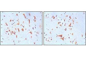 Immunohistochemical analysis of paraffin-embedded human brain tissues, showing cytoplasmic localization with DAB staining using FMR1 mouse mAb.