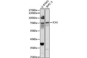 Western blot analysis of extracts of various cell lines, using IC antibody (7500) at 1:1000 dilution. (ICA1 抗体  (AA 1-160))