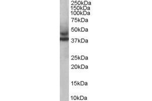ABIN184954 staining (1ug/ml) of Human Skeletal Muscle lysate (RIPA buffer, 35ug total protein per lane). (TRIM54 抗体  (C-Term))