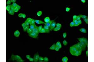 Immunofluorescence staining of PC-3 cells with ABIN7150389 at 1:133, counter-stained with DAPI. (RFXANK 抗体  (AA 3-84))